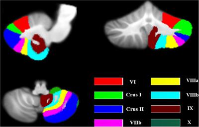 Changes in Resting-State Functional Connectivity of Cerebellum in Amnestic Mild Cognitive Impairment and Alzheimer’s Disease: A Case-Control Study